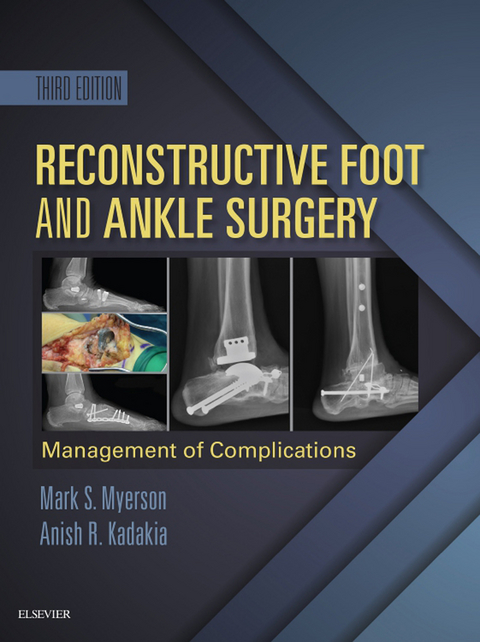 Reconstructive Foot and Ankle Surgery: Management of Complications E-Book -  Anish R. Kadakia,  Mark S. Myerson