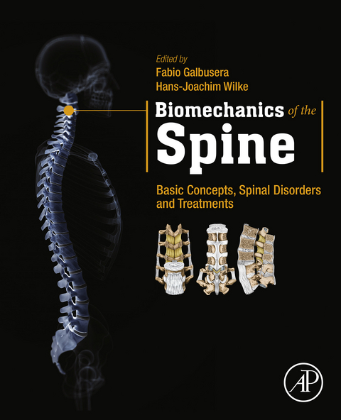 Biomechanics of the Spine - 
