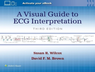 A Visual Guide to ECG Interpretation: Print + eBook with Multimedia - Susan Renee Wilcox, David F. M. Brown