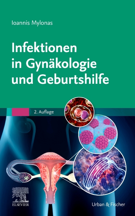 Infektionen in Gyn&auml;kologie und Geburtshilfe - Ioannis Mylonas