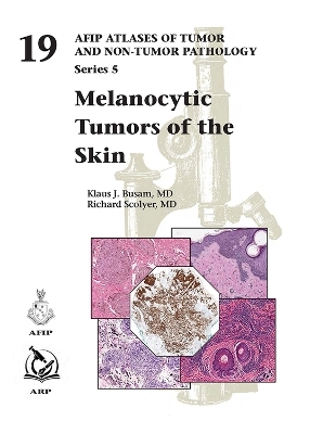 Melanocytic Tumors of the Skin - Klaus J. Busam, Richard Scolyer