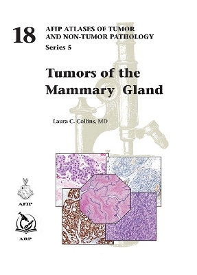 Tumors of the Mammary Gland - Laura C. Collins