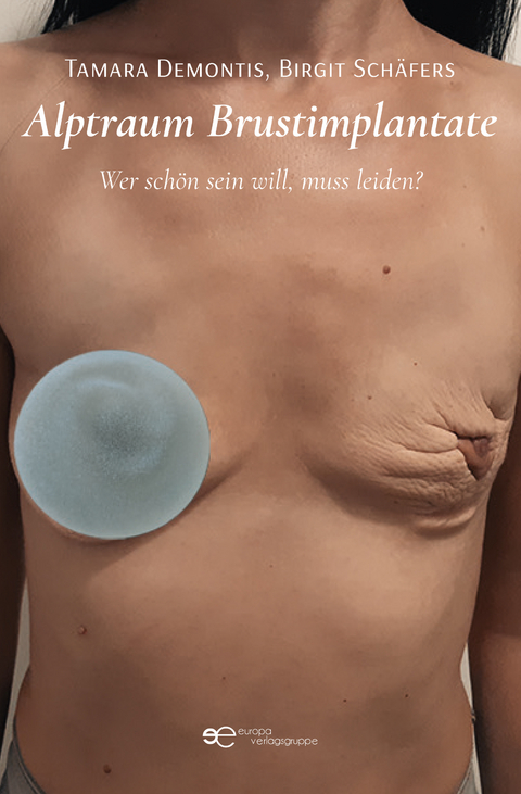 Alptraum Brustimplantate - Tamara Demontis, Birgit Schäfers