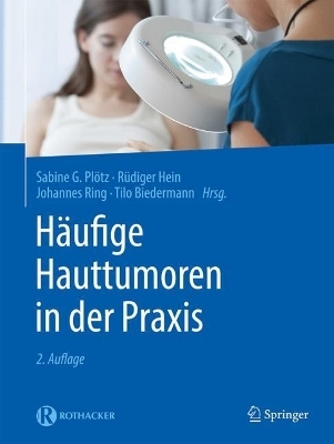 H&auml;ufige Hauttumoren in der Praxis - 