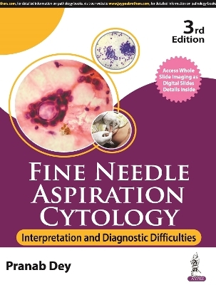 Fine Needle Aspiration Cytology