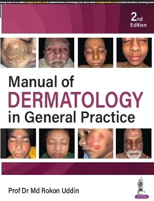 Manual of Dermatology in General Practice - Rokon Uddin