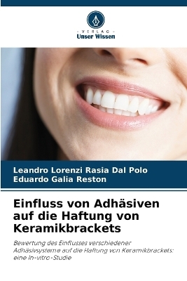 Einfluss von Adh&auml;siven auf die Haftung von Keramikbrackets - Leandro Lorenzi Rasia Dal Polo, Eduardo Galia Reston