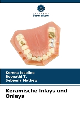 Keramische Inlays und Onlays
