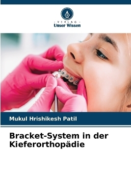 Bracket-System in der Kieferorthopädie