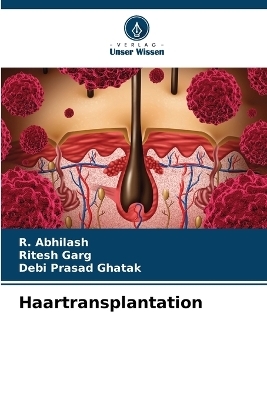 Haartransplantation - R Abhilash, Ritesh Garg, Debi Prasad Ghatak