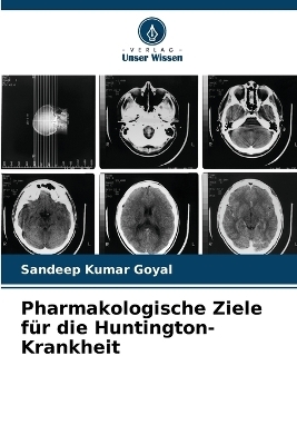 Pharmakologische Ziele für die Huntington-Krankheit