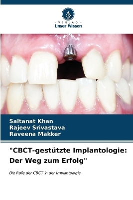 "CBCT-gest&uuml;tzte Implantologie - Saltanat Khan, Rajeev Srivastava, Raveena Makker