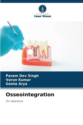 Osseointegration - Param Dev Singh, Varun Kumar, Geeta Arya