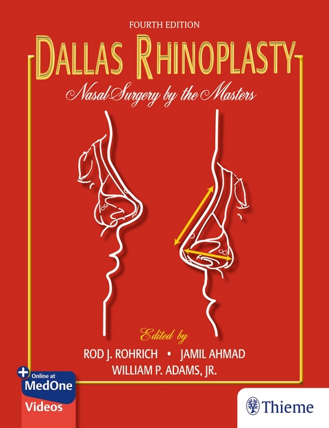 Dallas Rhinoplasty - 