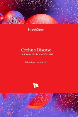 Crohn&rsquo;s Disease - 