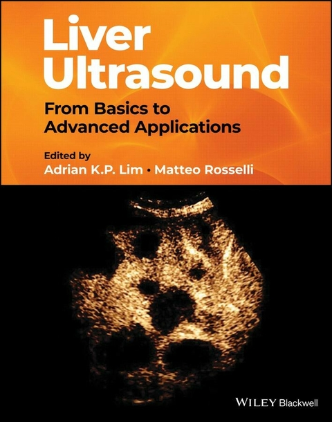Liver Ultrasound - 
