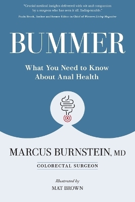 Bummer - Marcus Burnstein