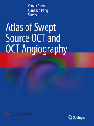 Atlas of Swept Source OCT and OCT Angiography
