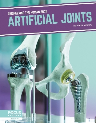 Artificial Joints - Marne Ventura