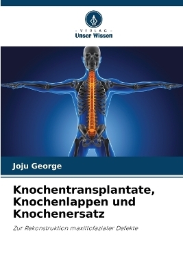 Knochentransplantate, Knochenlappen und Knochenersatz