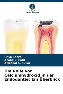 Die Rolle von Calciumhydroxid in der Endodontie - Priya Sapra, Anand C Patil, Amritpal S Kullar