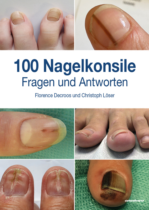 100 Nagelkonsile - Christoph L&ouml;ser, Florence Decroos