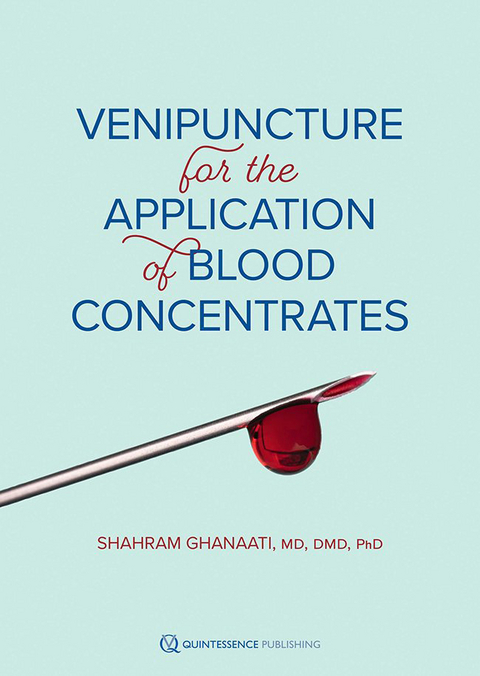 Venipuncture for the Application of Blood Concentrates - Shahram Ghanaati