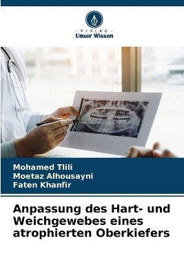 Anpassung des Hart- und Weichgewebes eines atrophierten Oberkiefers - Mohamed Tlili, Moetaz Alhousayni, Faten Khanfir