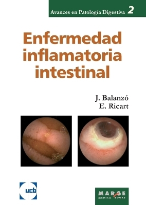 Enfermedad inflamatoria intestinal - Elena Ricart G&oacute;mez, Joaquim Balanz&oacute; Tintor&eacute;