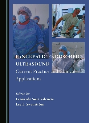 Pancreatic Endoscopic Ultrasound - 