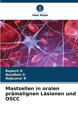 Mastzellen in oralen pr&auml;malignen L&auml;sionen und OSCC - Rupesh H, Nandhini G, Rajkumar K