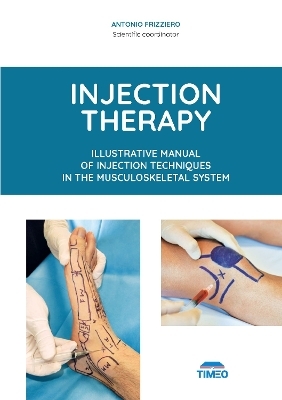 Injection Therapy