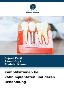 Komplikationen bei Zahnimplantaten und deren Behandlung - Sujeet Patil, Akash Gopi, Shalabh Kumar