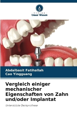 Vergleich einiger mechanischer Eigenschaften von Zahn und/oder Implantat - Abdalbasit Fatihallah, Cao Yingguang