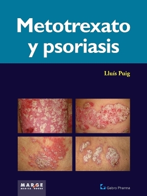Metotrexato y psoriaris - Llu&iacute;s Puig Sanz
