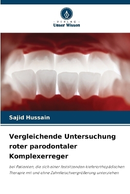 Vergleichende Untersuchung roter parodontaler Komplexerreger