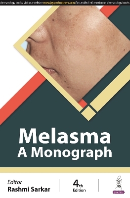 Melasma - Rashmi Sarkar