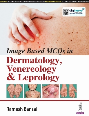 Image Based MCQs in Dermatology, Venereology & Leprology - Ramesh Bansal