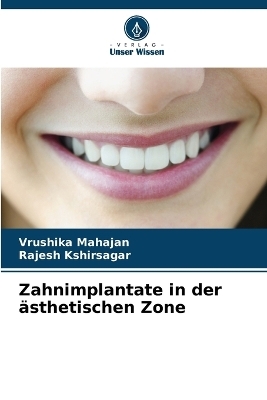 Zahnimplantate in der ästhetischen Zone