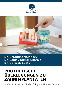 Prothetische Überlegungen Zu Zahnimplantaten