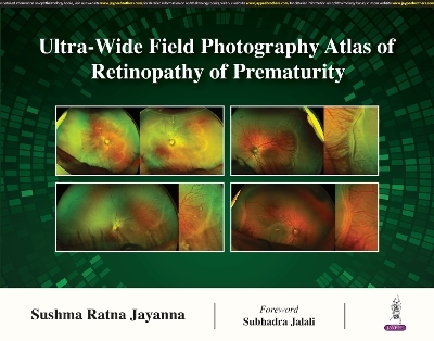 Ultra-Wide Field Photography Atlas of Retinopathy of Prematurity - Sushma Ratna Jayanna
