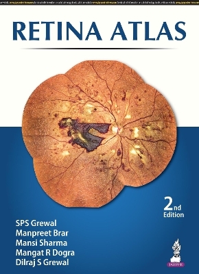 Retina Atlas - SPS Grewal, Manpreet Brar, Mansi Sharma, R Mangat Dogra, S Dilraj Grewal