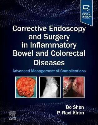 Corrective Endoscopy and Surgery in Inflammatory Bowel and Colorectal Diseases - 