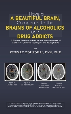 I Have a Beautiful Brain, Compared to the Brains of Alcoholics and Drug Addicts - DVM Odendhal  PhD  Stewart