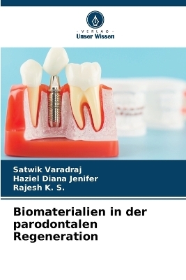 Biomaterialien in der parodontalen Regeneration - Satwik Varadraj, Haziel Diana Jenifer, Rajesh K S