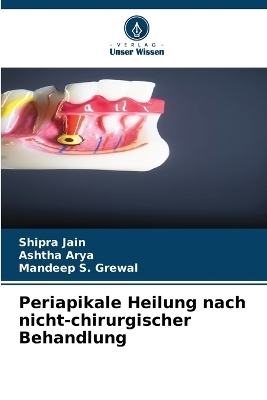 Periapikale Heilung nach nicht-chirurgischer Behandlung - Shipra Jain, Ashtha Arya, Mandeep S Grewal