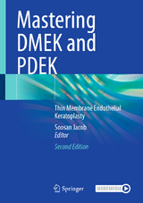 Mastering DMEK and PDEK - Jacob, Soosan