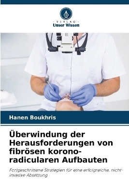 Überwindung der Herausforderungen von fibrösen korono-radicularen Aufbauten
