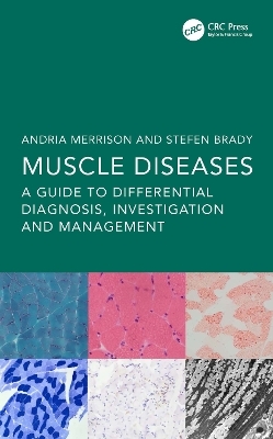 Muscle Diseases - 