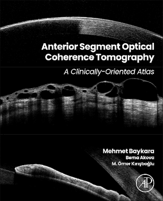 Anterior Segment Optical Coherence Tomography